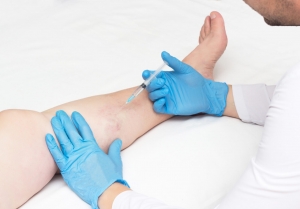 Why A Vein Centre Is Efficient For Vein Management In New Jersey?